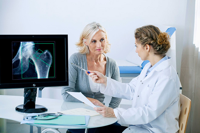 профилактика остеопороза у женщин
